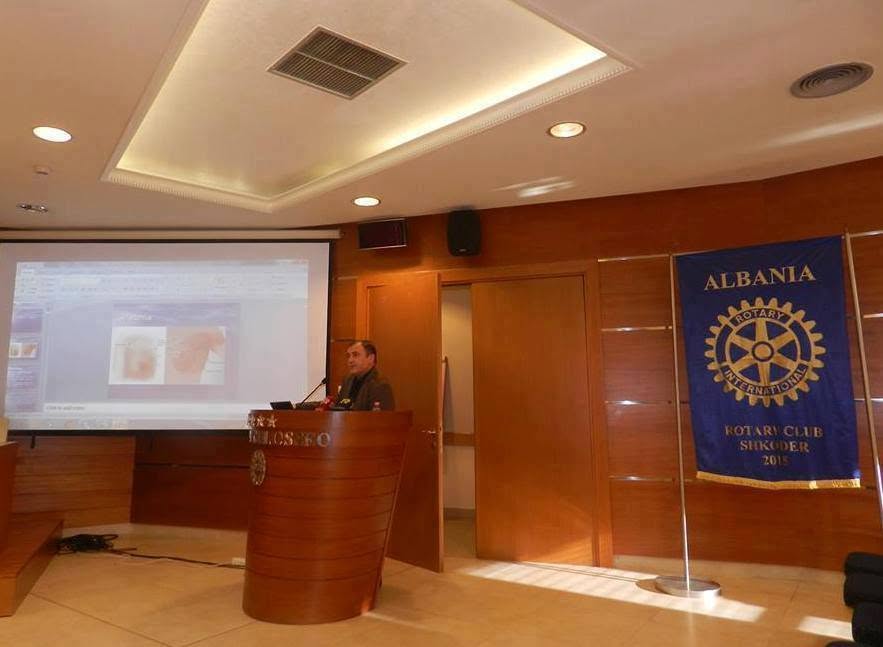 Takim informues për kancerin e gjirit — Rotary Club Shkodër